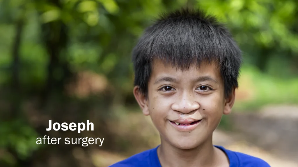 joseph after 24