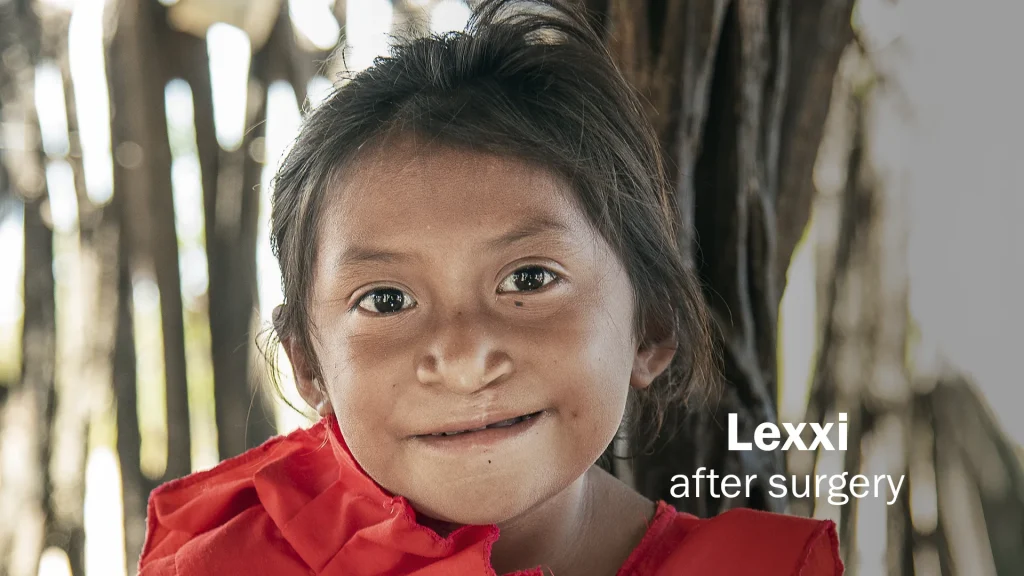 lexxi after 24