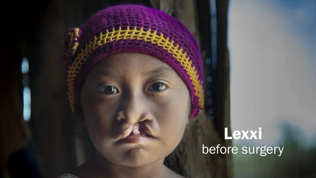 lexxi before 24